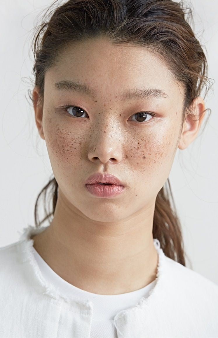 Pigmentation & Dark Spots - Koreanskinca.re