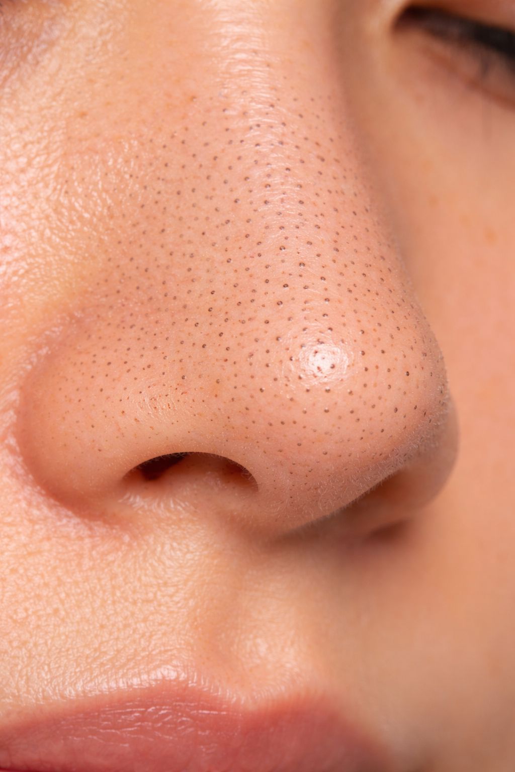 Pores & Congestion - Koreanskinca.re