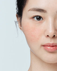 Shop by Skin Concern - Koreanskinca.re