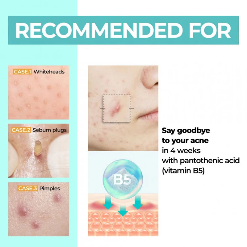 numbuzin No.1 Pantothenic B5 Active Soothing Cream 80ml