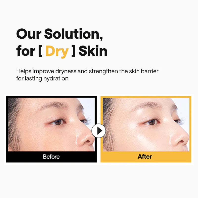 Before and after comparison of dry skin solution on a person's face.