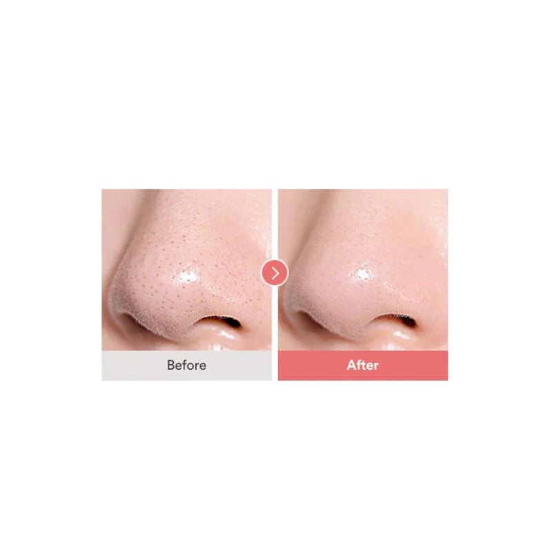 TOCOBO Calamine Pore Control Cleansing Oil