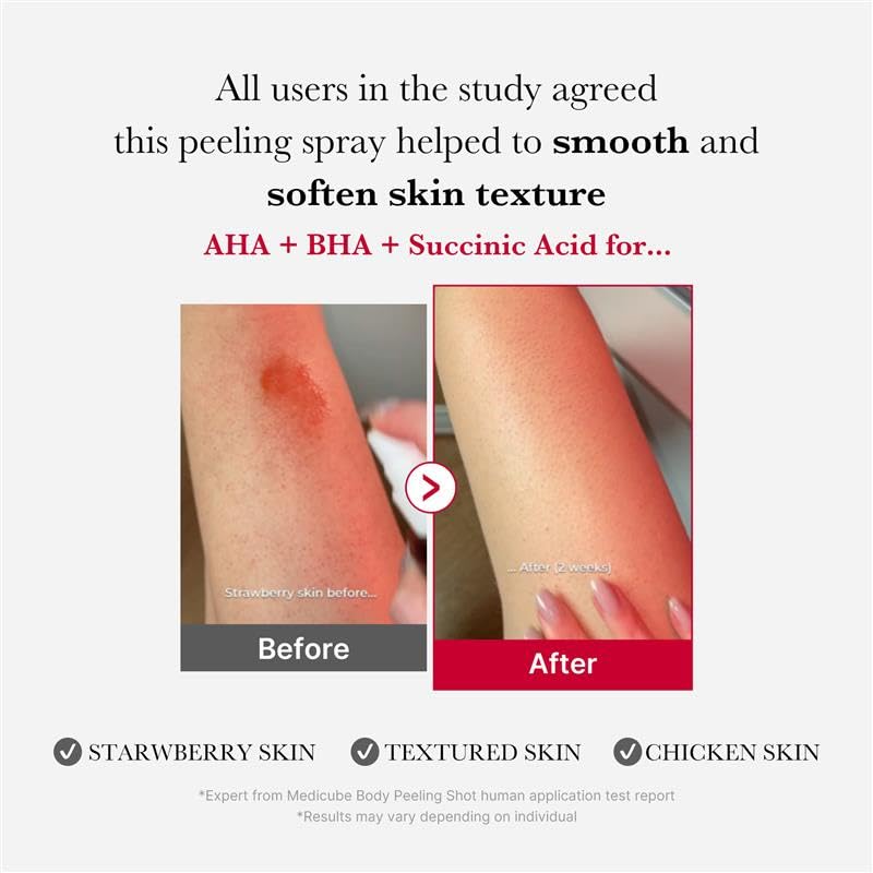 medicube Red Acne Body Peeling Shot 110g