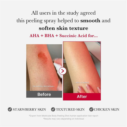 medicube Red Acne Body Peeling Shot 110g